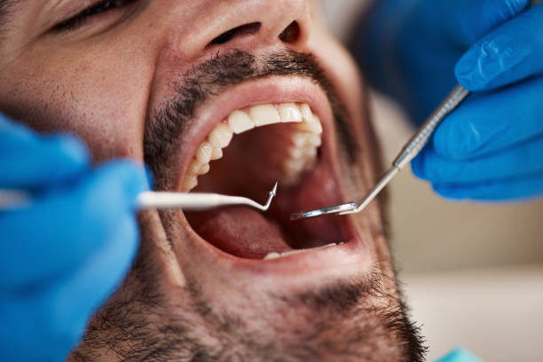Best Emergency Dentist for Knocked-Out Tooth in Derby, CT
